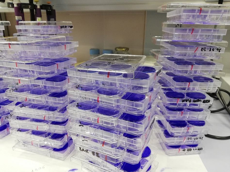 Tissue culture plates stained for flavivirus quantification