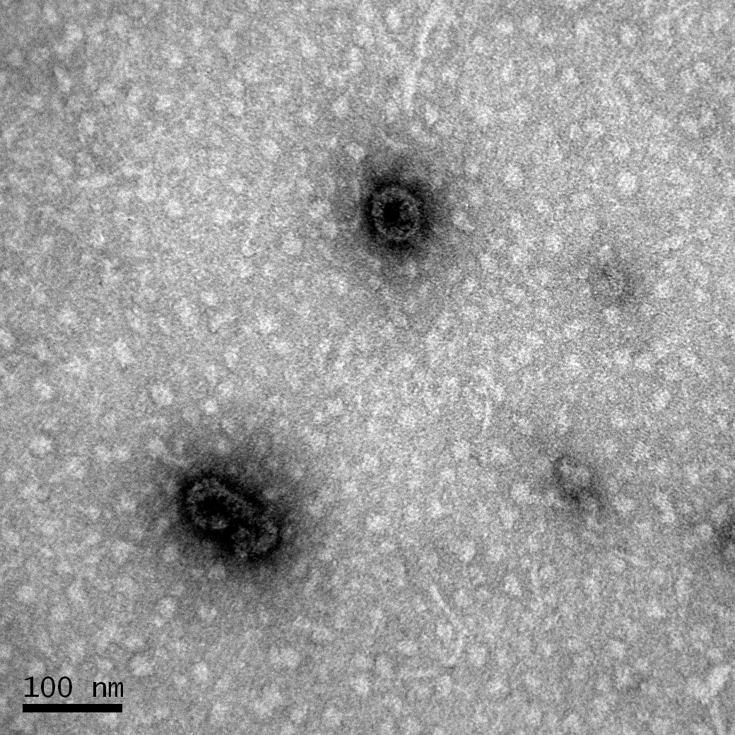 Virus-like particles (VLPs) of infectious pancreatic necrosis virus (IPNV) obtained in Pichia pastoris.