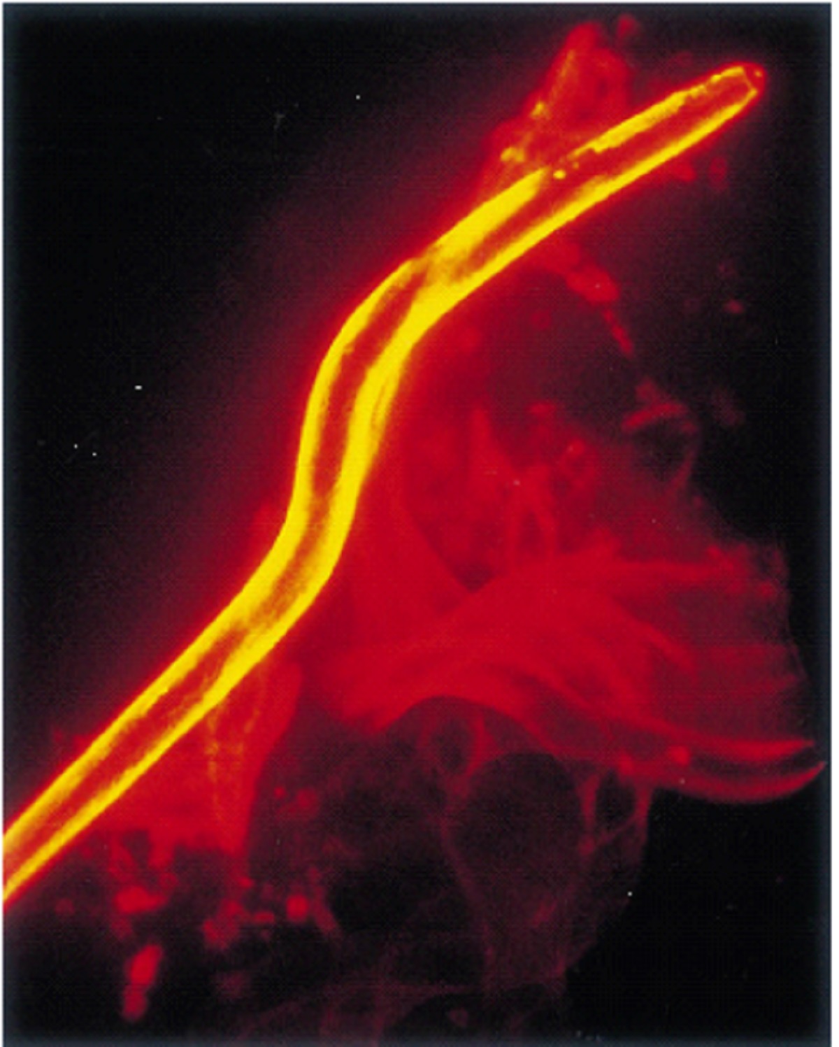 Inmunofluorescencia de peroxiredoxina en G. rostochiensis