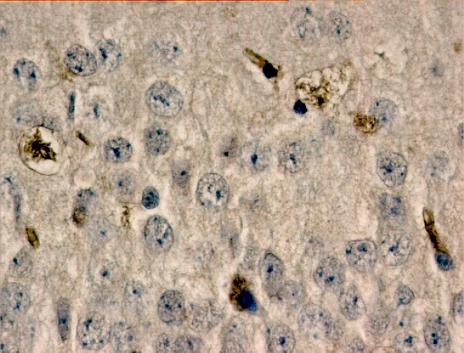 Immunohistochemical staining of mouse neurons infected with West Nile virus (brown).